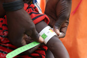 Young child having his arm circumference measured to check for malnutrition